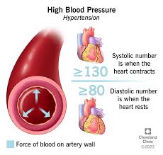 high blood pressure