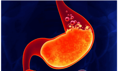 Everything you need to know about stomach acid
