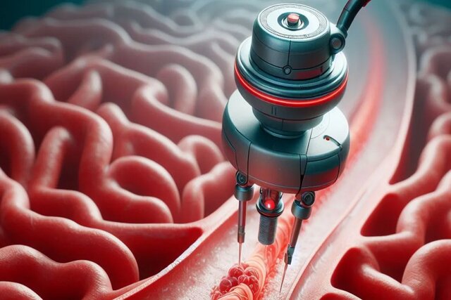 This robot can open the veins with high precision
