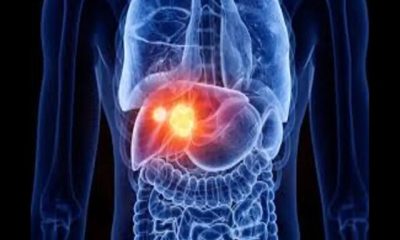 Testing a vaccine that reduces liver tumors